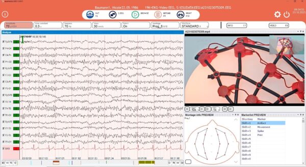 Esumedics EEG Software - Video EEG in Full HD Resolution