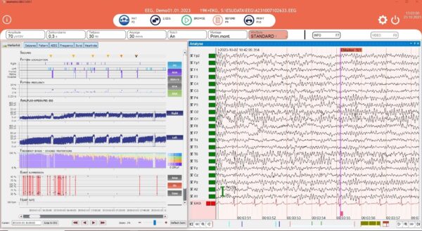 esumedics EEG Software - NeuroTrend Add-on (encevis Software* von AIT, CE 0483)