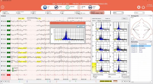 esumedics EEG Software - Mit praktischen Standard Analyse Funktionen
